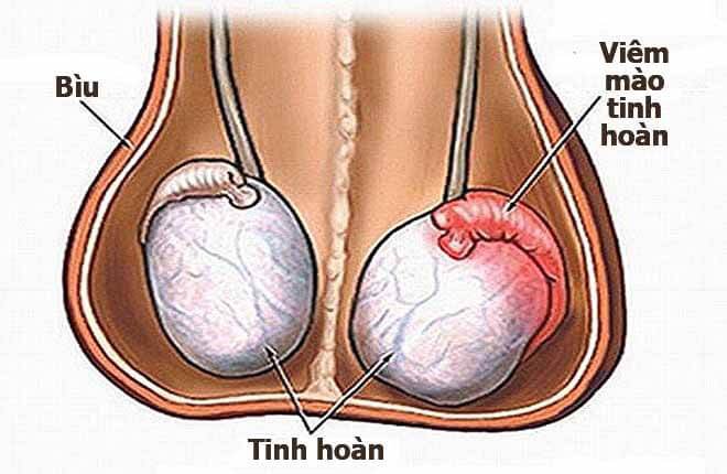 Top 10 phòng khám chữa đau tinh hoàn bên trái ở Bắc Ninh uy tín chất lượng