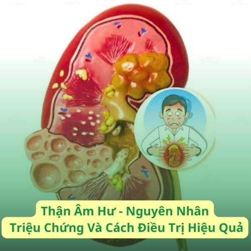 Thận Âm Hư - Nguyên Nhân, Triệu Chứng và Cách Điều Trị Hiệu Quả