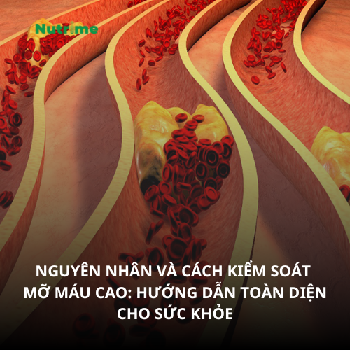 Nguyên Nhân Và Cách Kiểm Soát Mỡ Máu Cao: Hướng Dẫn Toàn Diện Cho Sức