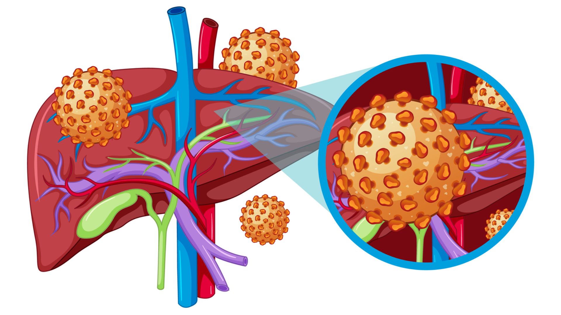 viem-gan-b-la-gi.jpg?v=1