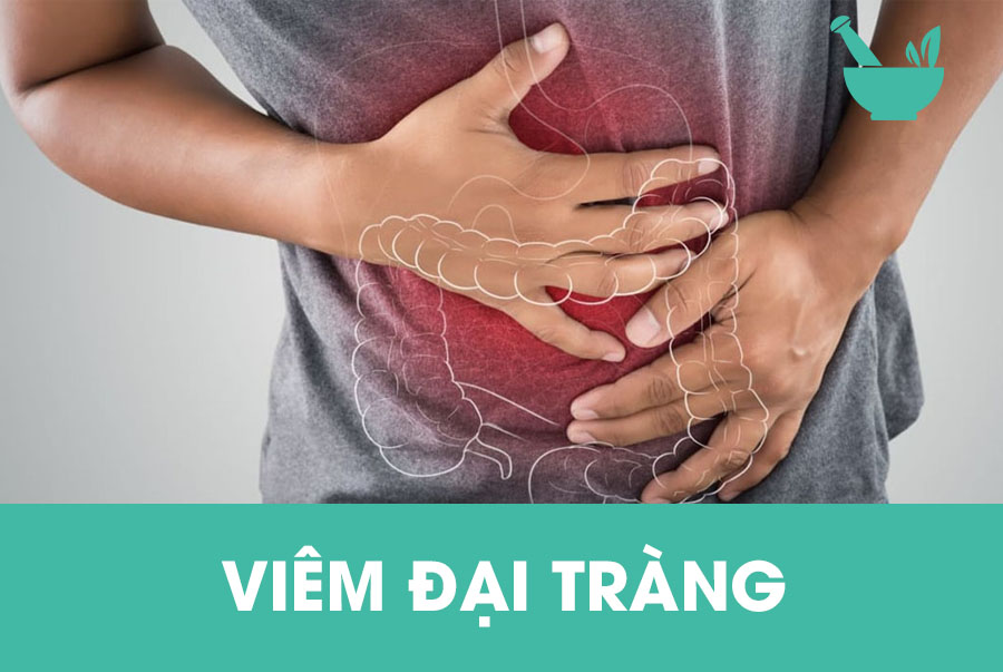 Viêm đại tràng