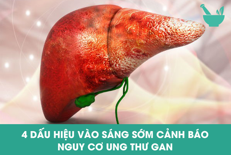 4 DẤU HIỆU VÀO SÁNG SỚM CẢNH BÁO NGUY CƠ UNG THƯ GAN