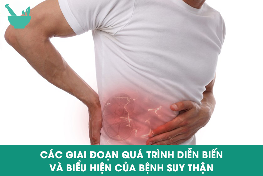 Các giai đoạn quá trình diễn biến và biểu hiện của bệnh suy thận 