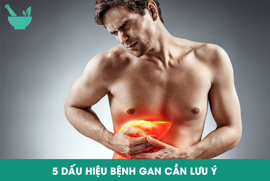 5 DẤU HIỆU BỆNH GAN CẦN LƯU Ý