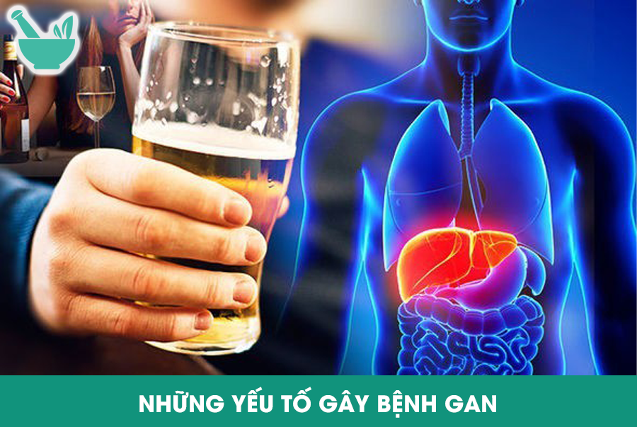 NHỮNG YẾU TỐ GÂY BỆNH GAN