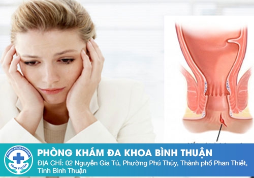Tìm Hiểu Về Các Loại Thuốc Trị Nứt Kẽ Hậu Môn