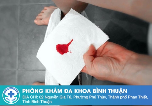 Cách Phân Biệt Máu Kinh Và Máu Sảy Thai - Thông Tin Cho Chị Em