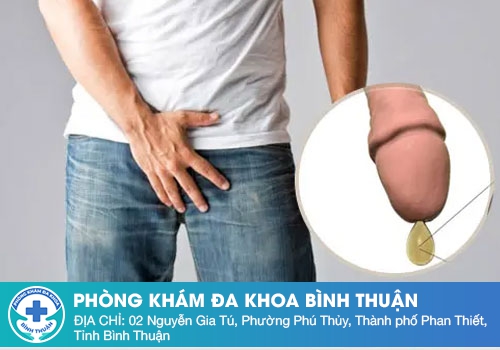 Dương Vật Chảy Dịch Vàng - Nguyên Nhân Và Cách Điều Trị Hiệu Quả