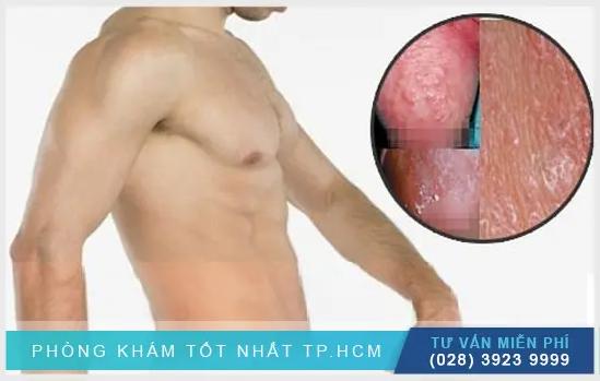 Nguyên Nhân Bao Quy Đầu Bị Khô Nứt Và Cách Khắc Phục Hiệu Quả