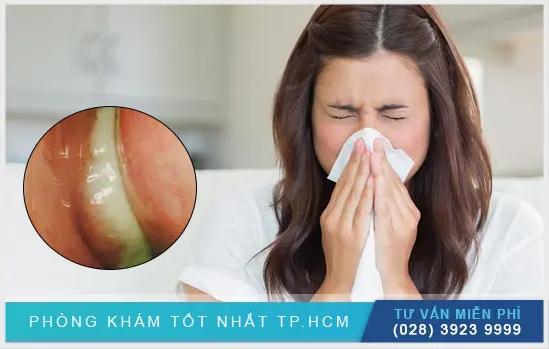 Nguyên Nhân Và Địa Chỉ Điều Trị Mũi Có Mủ Vàng Uy Tín Tại TP.HCM