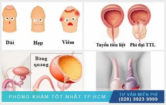 Tìm Hiểu Địa Chỉ Phòng Khám Nam Khoa Uy Tín Ở Huyện Hóc Môn