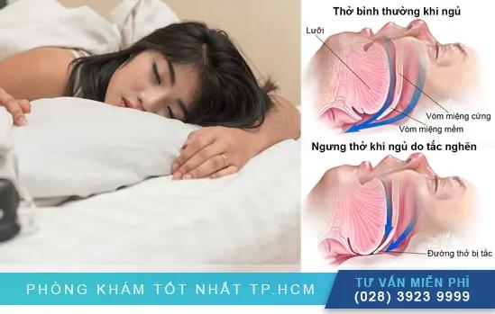 Nhận Biết Và Phòng Ngừa Các Yếu Tố Nguy Cơ Ngưng Thở Khi Ngủ