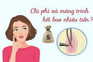 Vá màng trinh hết bao nhiêu tiền? Vá màng trinh ở đâu
