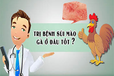 địa chỉ khám chữa bệnh sùi mào gà ở đâu tốt nhất tại Hà Nội