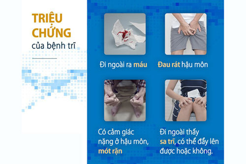 Dấu hiệu, triệu chứng bệnh trĩ