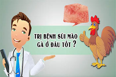 Địa chỉ chữa sùi mào gà ở đâu tốt với chi phí phù hợp tại Hà Nội?