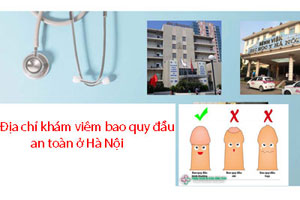 11 địa chỉ khám viêm bao quy đầu ở đâu tốt, uy tín ở Hà Nội