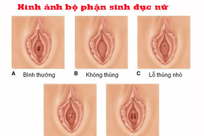 Hình ảnh bộ phận sinh dục nữ bất thường