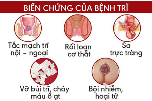 Một số biến chứng của bệnh trĩ