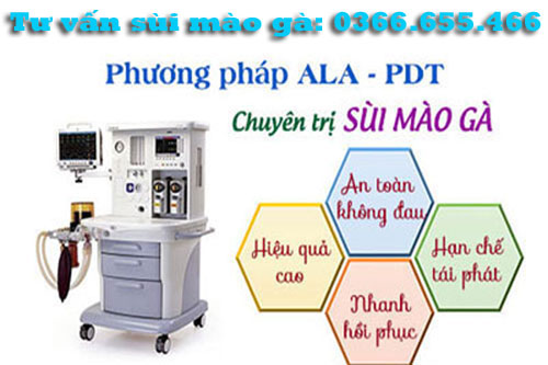 11 Cách chữa bệnh sùi mào gà hiệu quả tốt nhất tại nhà