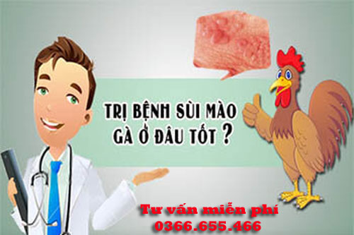 Top 10 địa chỉ khám chữa bệnh sùi mào gà ở đâu tốt nhất Hà Nội