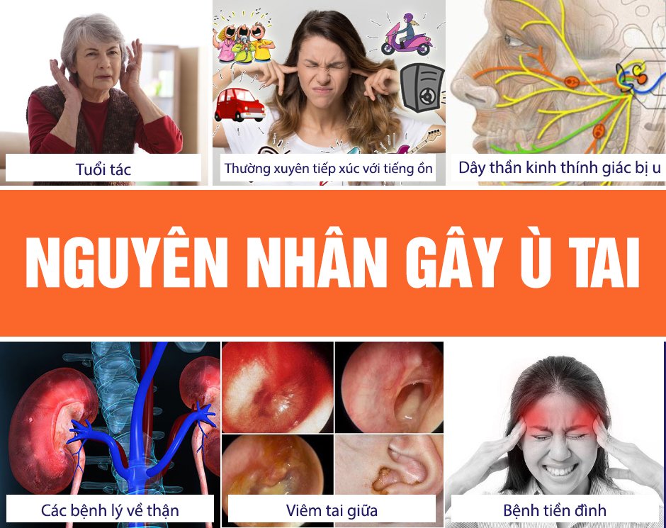 Người bệnh ù tai cần lưu ý gì trong chế độ ăn uống hàng ngày?