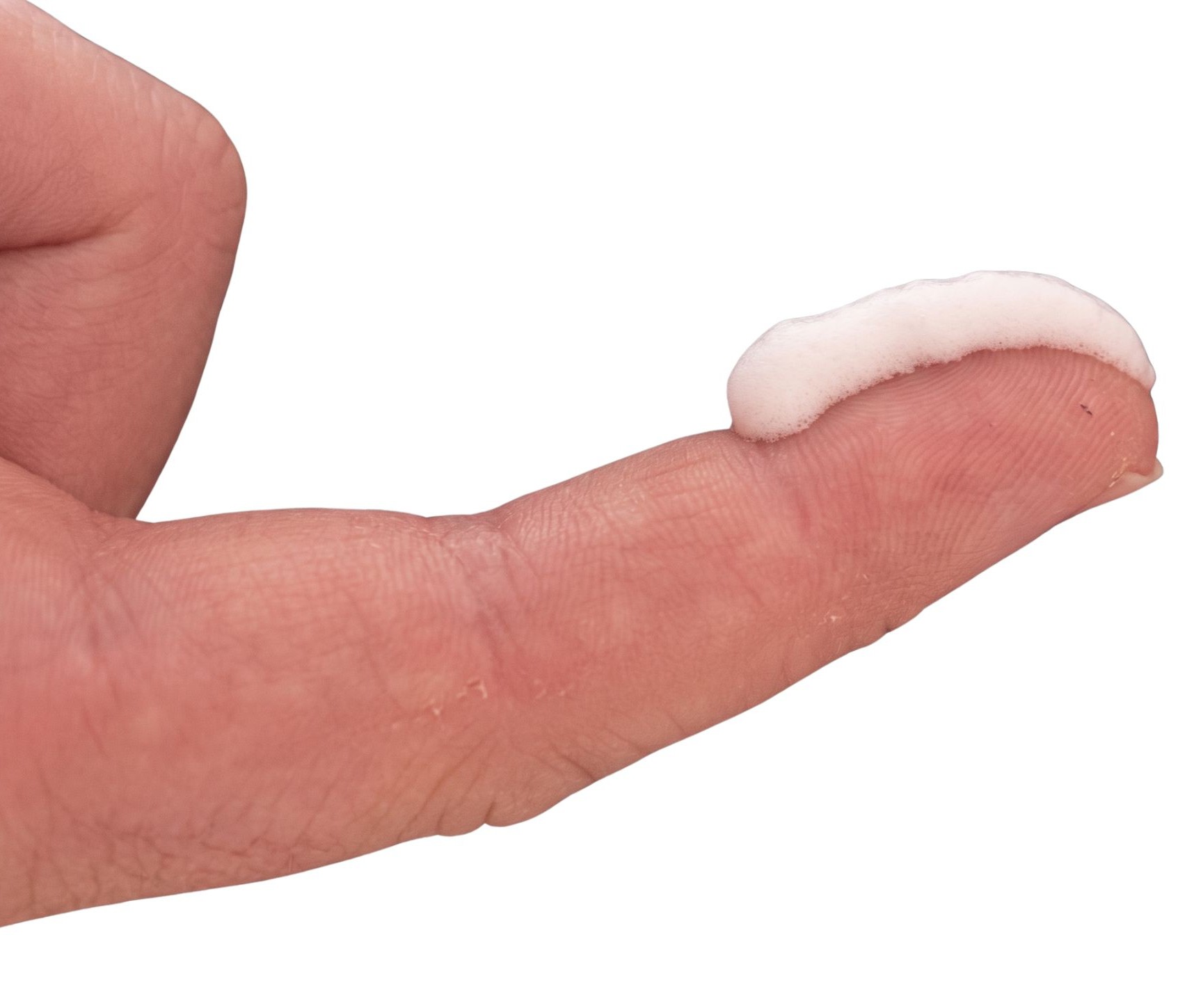 Một lượng kem b&ocirc;i da tr&ecirc;n đầu ng&oacute;n tay người lớn minh họa kh&aacute;i niệm Fingertip Unit &ndash; đơn vị đo liều corticosteroid b&ocirc;i ngo&agrave;i da