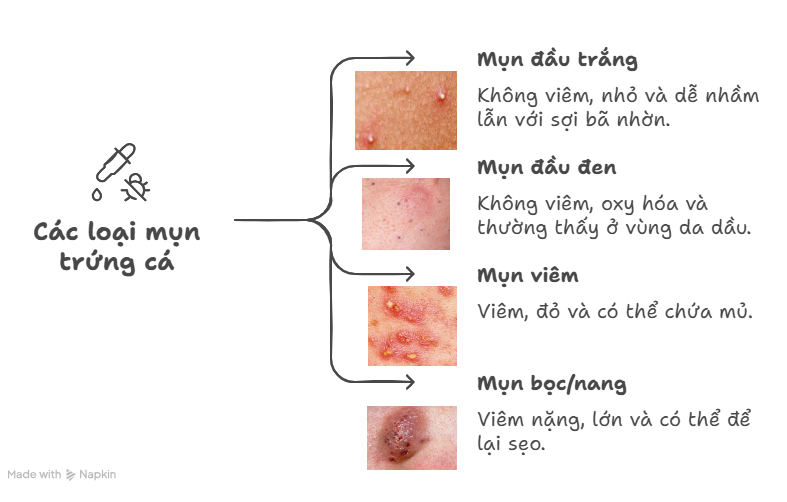 Các loại mụn trứng cá