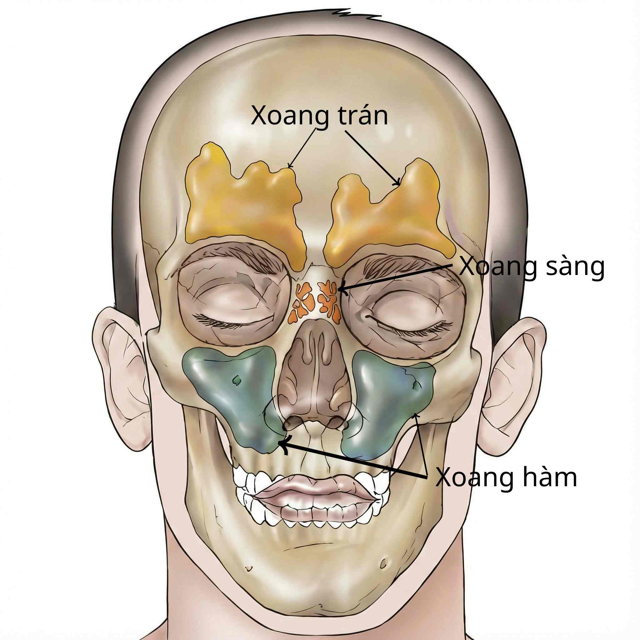 Sơ đồ giải phẫu vị tr&iacute; c&aacute;c xoang cạnh mũi (xoang tr&aacute;n, xoang s&agrave;ng, xoang h&agrave;m) - nơi sản sinh kh&iacute; Nitric Oxide nồng độ cao.