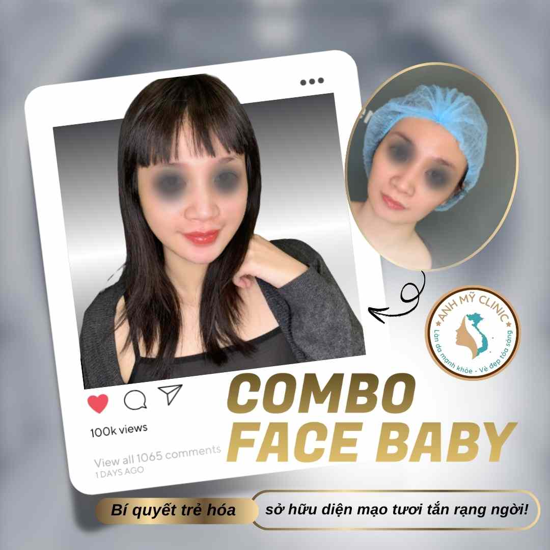 combo-faqce-lip.jpg?v=1 Combo mặt-môi