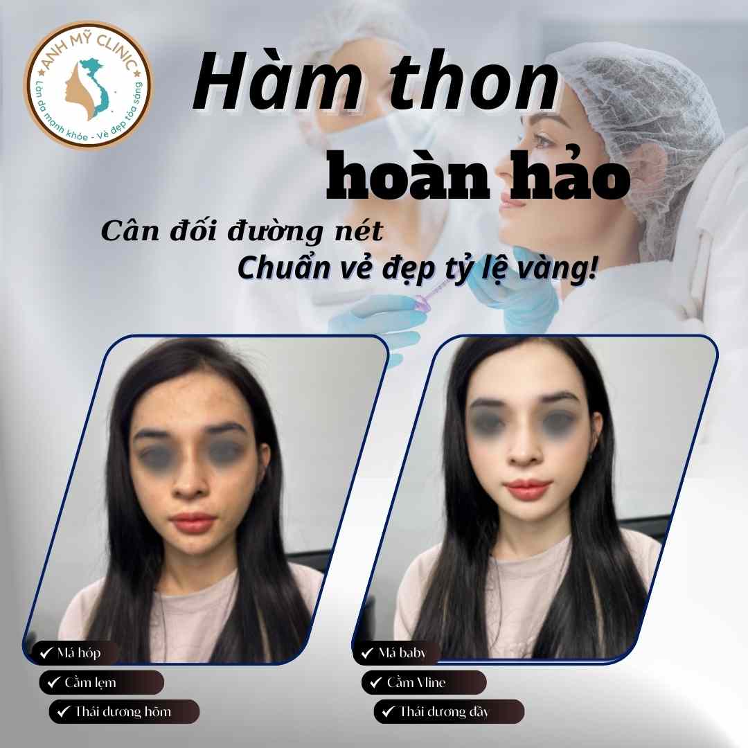 Combo má-cằm-thái dương