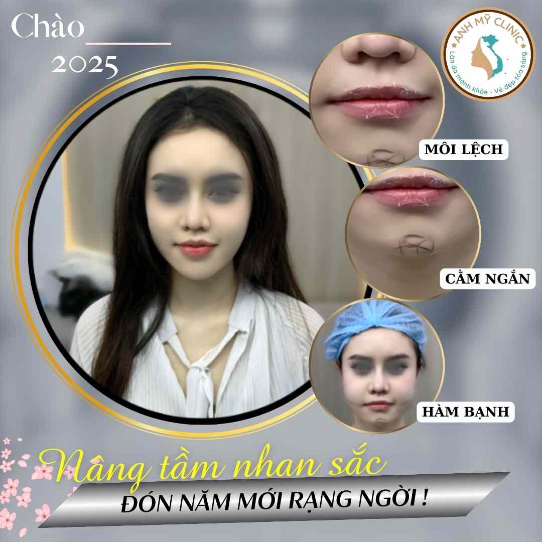 combo-moi-cam-ham.jpg?v=1 Combo môi-cằm-góc hàm