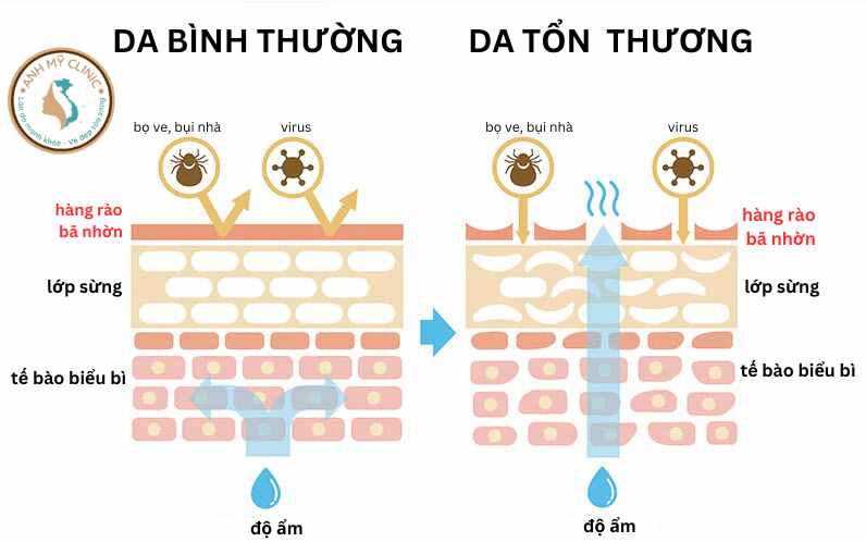 Hàng rào bã nhởn bảo vệ da