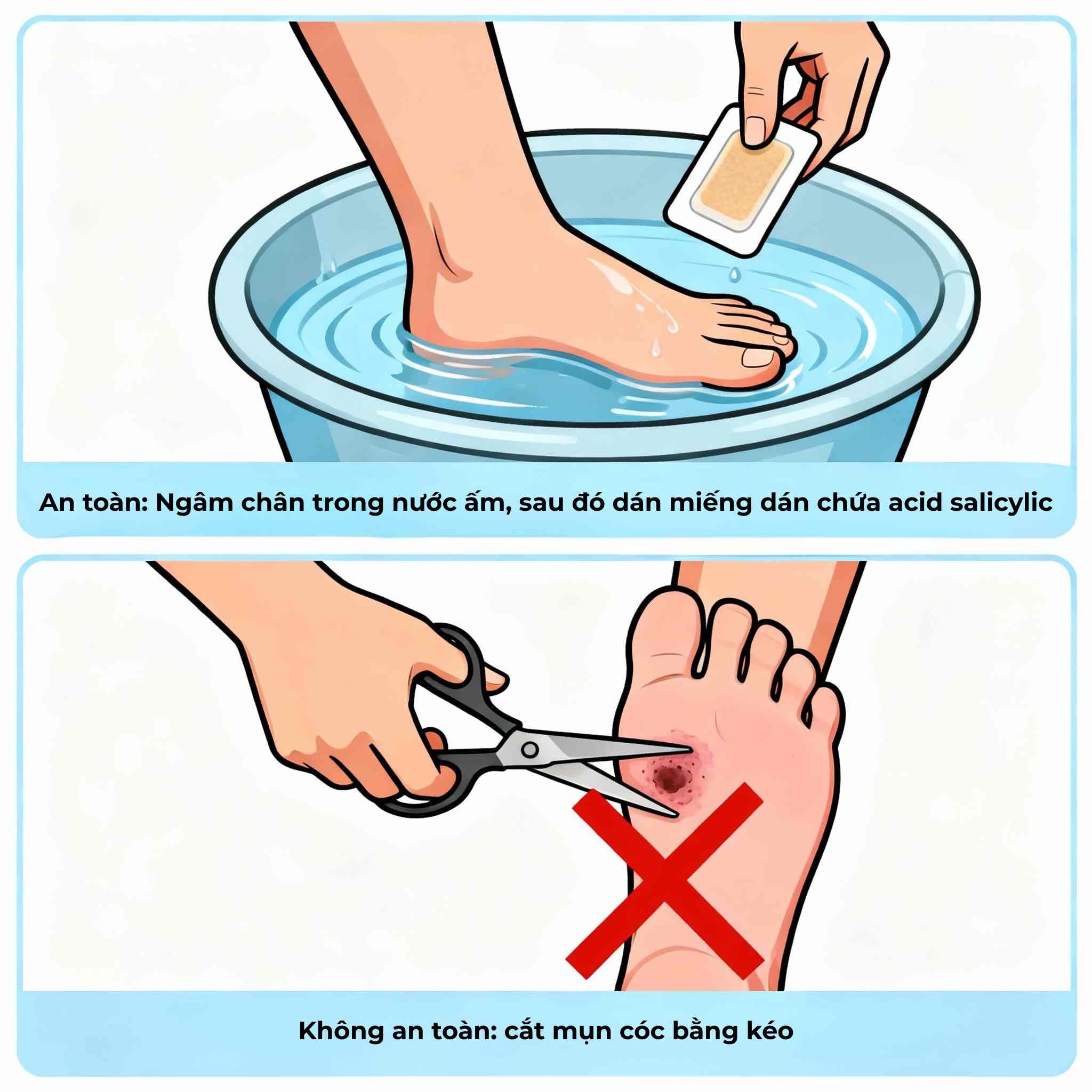 dieu-tri-mun-coc-tai-nha.jpg Minh họa so sánh điều trị mụn cóc tại nhà an toàn bằng acid salicylic và nguy hiểm khi tự cắt nặn