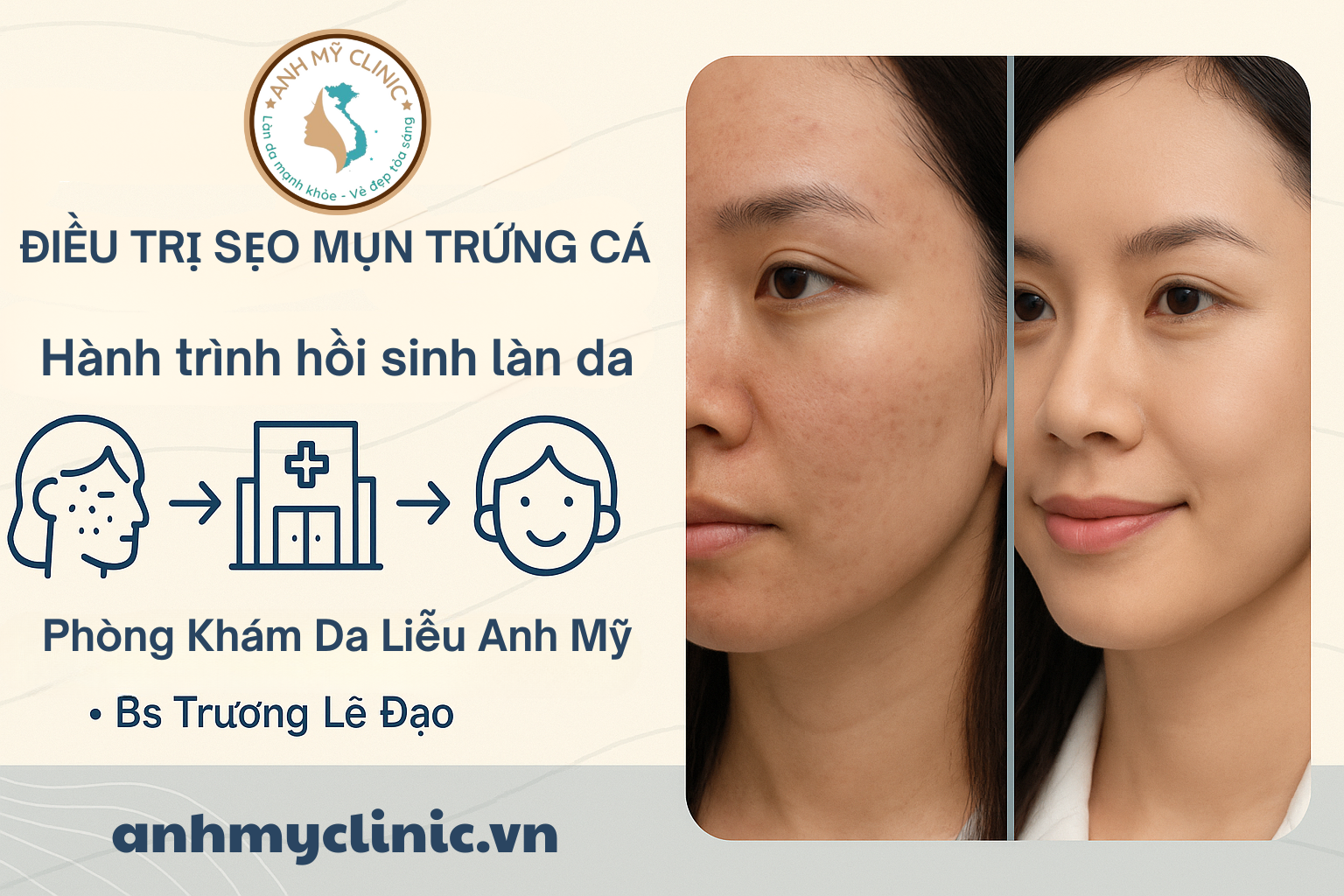 Điều Trị Sẹo Mụn Trứng Cá An Toàn Hiệu Quả | Bs Trương Lê Đạo