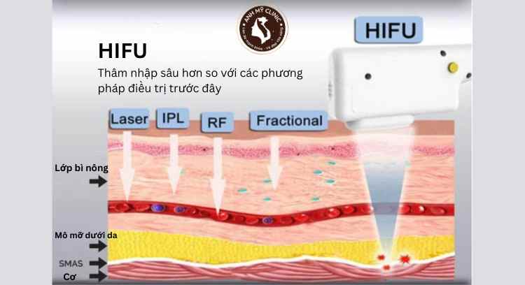 Độ xuyên thấu của các công cụ thẩm mỹ da