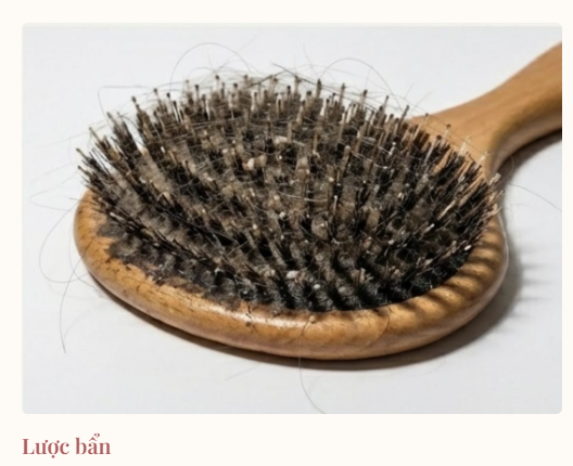 Cận cảnh chiếc lược chải t&oacute;c bẩn t&iacute;ch tụ đầy t&oacute;c rụng, bụi bẩn, g&agrave;u v&agrave; tế b&agrave;o chết - nguy&ecirc;n nh&acirc;n g&acirc;y nấm da đầu.
