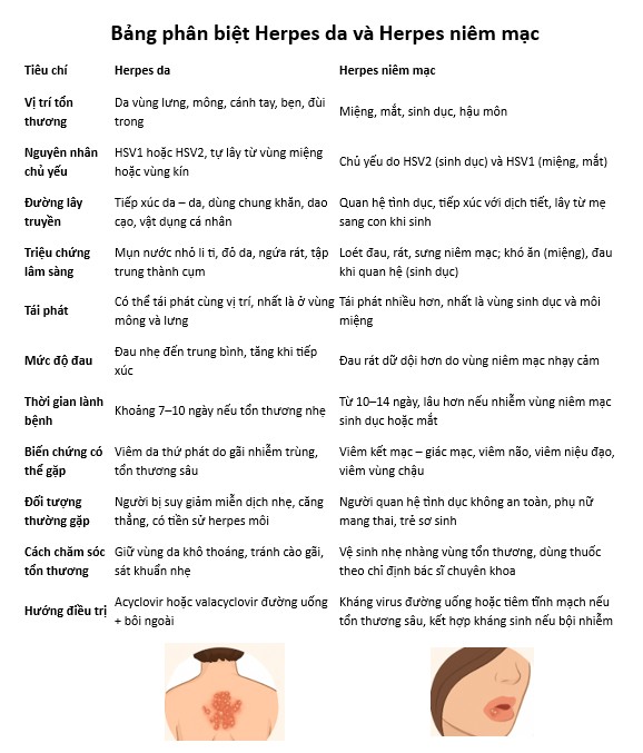 Inforgraphic phân biệt Herpes da và Herpes niêm mạc
