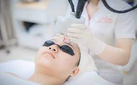 Hiểu Rõ Về Laser Trị Sẹo