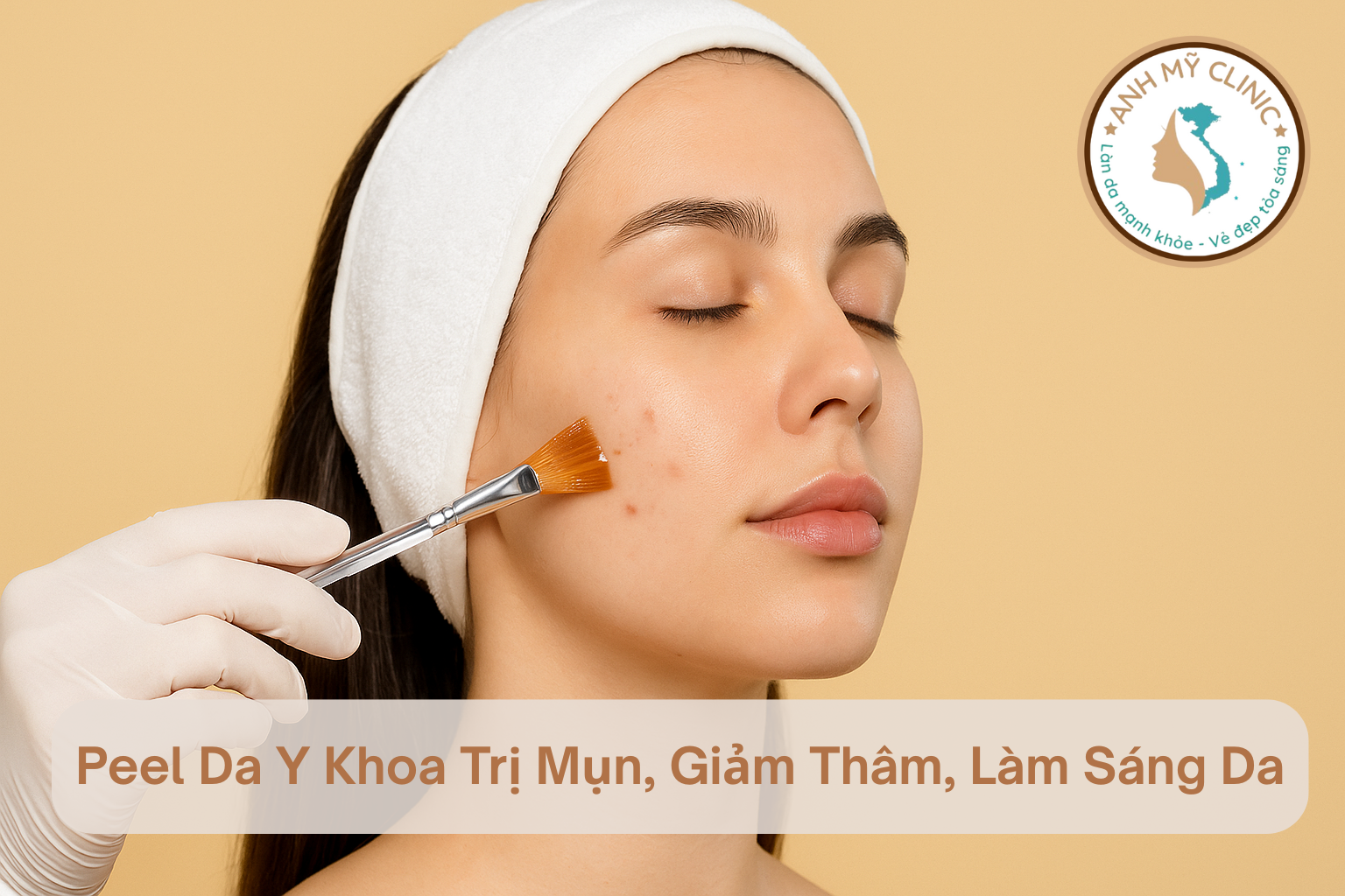 Peel Da Y Khoa Trị Mụn, Giảm Thâm, Làm Sáng Da | Anh Mỹ Clinic