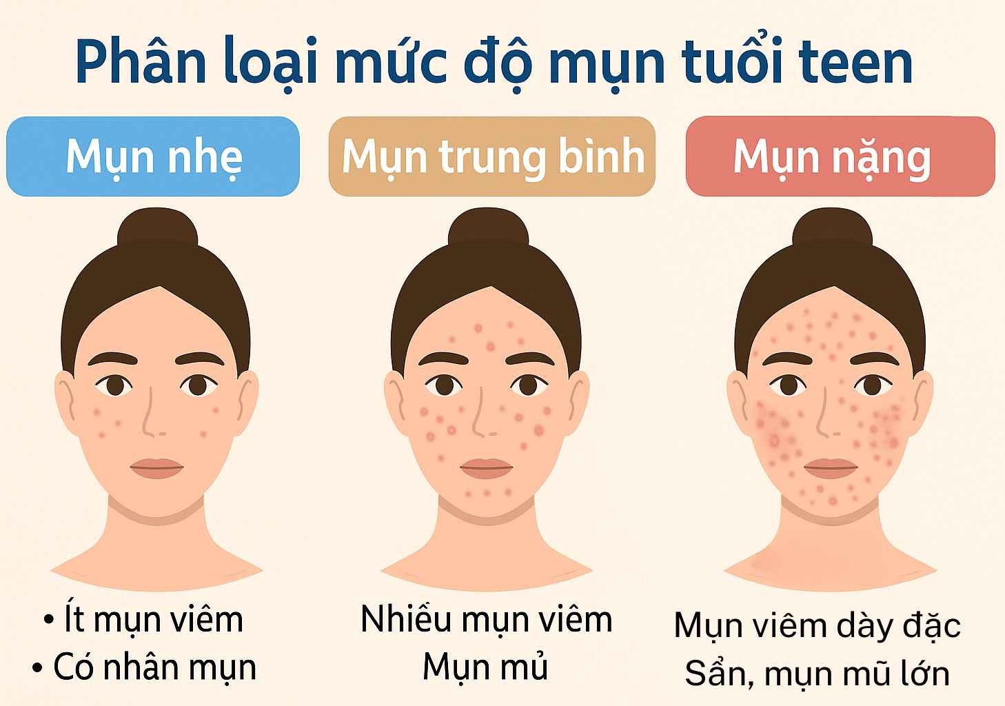 phan-loai-muc-do-mun-tuoi-teen.jpg Phân loại mức độ mụn tuổi teen