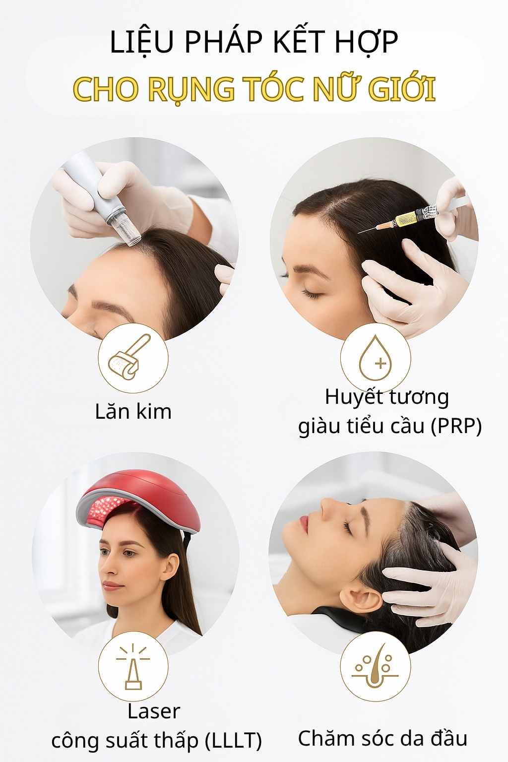 Minh họa c&aacute;c phương ph&aacute;p hỗ trợ (microneedling, PRP, laser) gi&uacute;p tăng hiệu quả điều trị rụng t&oacute;c kiểu nữ.
