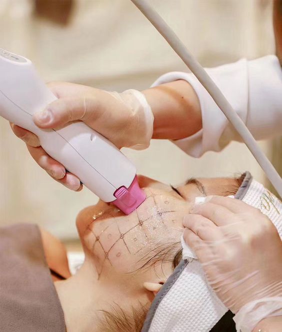 rf-vi-kim-tre-hoa-da-anhmy.jpg Điều trị trẻ hóa da bằng sóng RF vi kim giúp săn chắc và giảm nếp nhăn tại Anh Mỹ Clinic