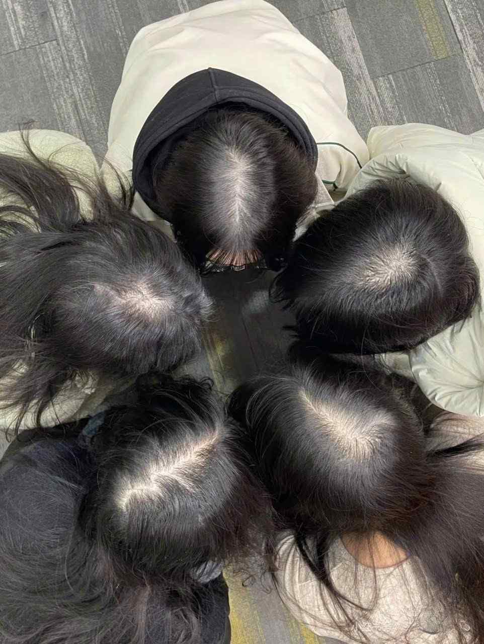 rung-toc-noi-tiet-to-o-nu.jpg Rụng tóc nội tiết tố ở nữ / Rụng tóc do di truyền ở nữ