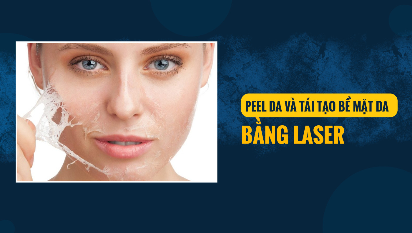 So sánh hai phương pháp thẩm mỹ: Peel da và tái tạo bề mặt da bằng laser