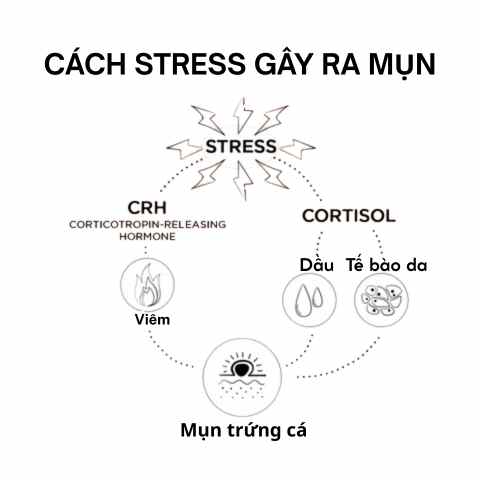Stress v&agrave; da dầu mụn