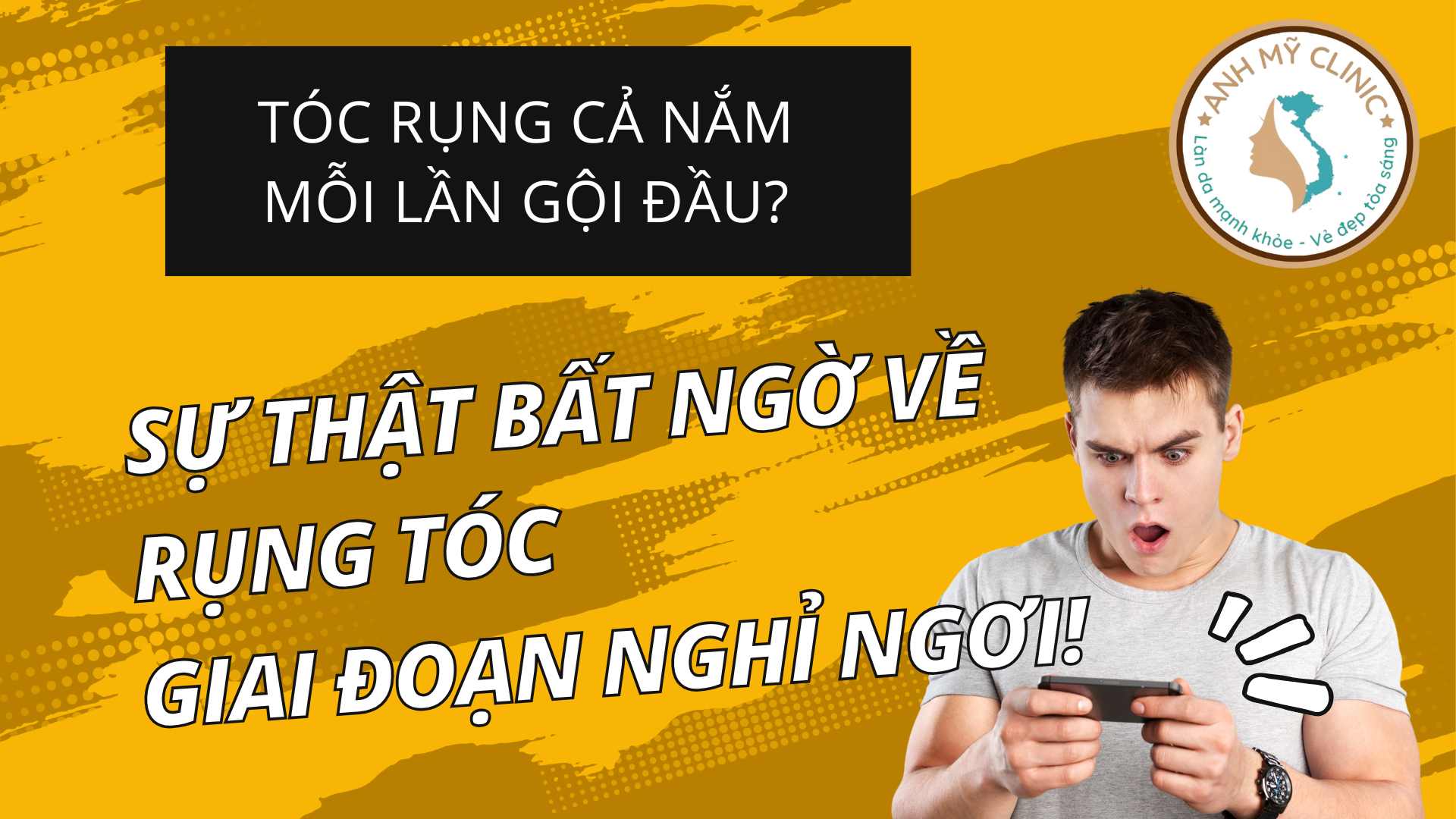 Rụng Tóc Giai Đoạn Nghỉ Ngơi: Nguyên Nhân, Triệu Chứng và Cách Khắc Phục