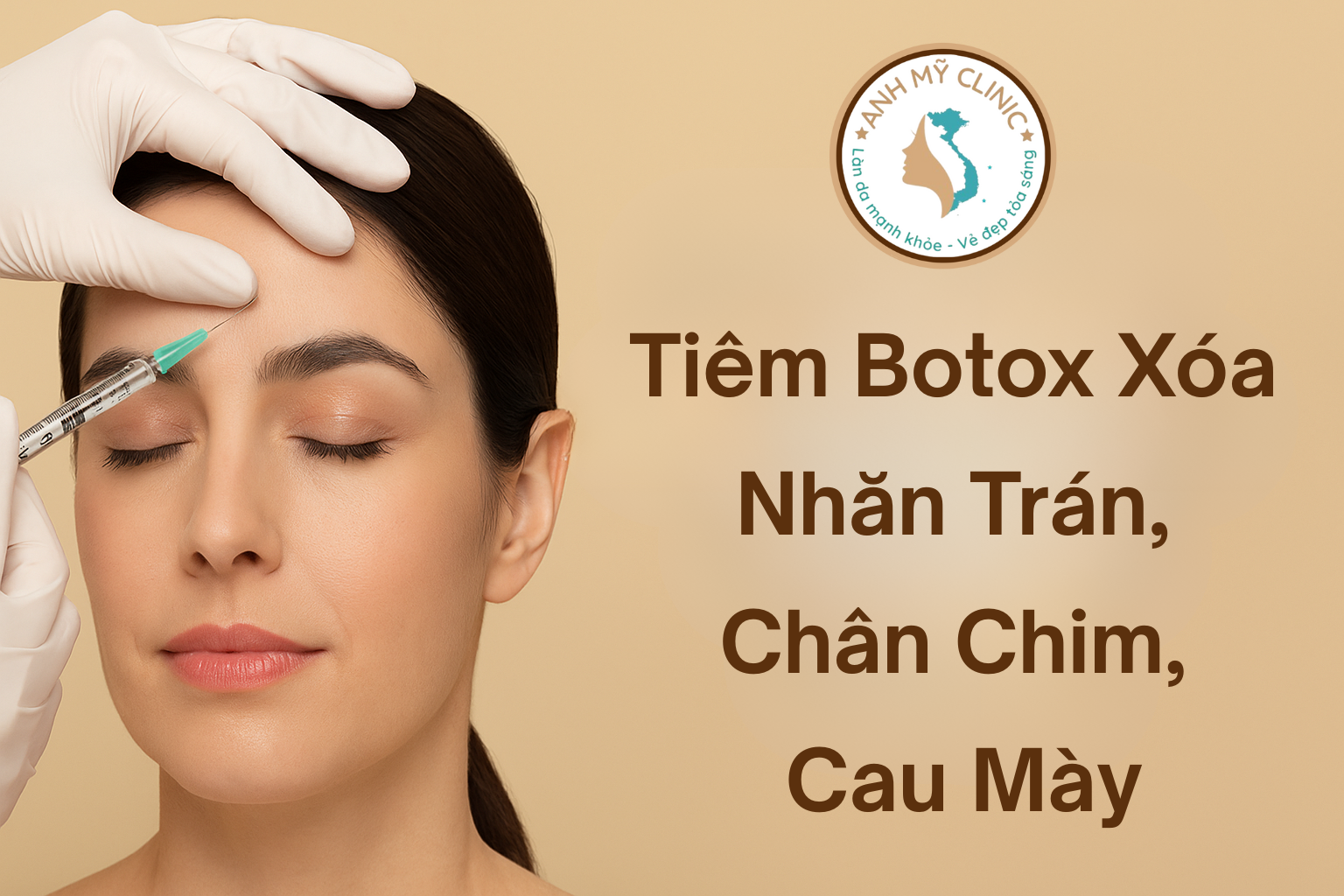 tiem-botox-xoa-nhan-tran-chan-chim-cau-may.png Tiêm botox xóa nhăn trán, chân chim, cau mày