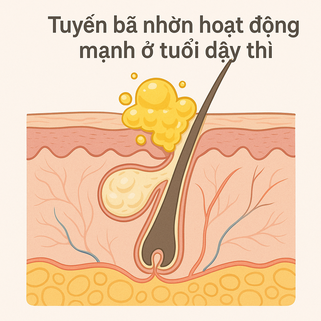 tuyen-ba-nhon-hoat-dong-manh-o-tuoi-day-thi.png Tuyến bã nhờn hoạt động mạnh ở tuổi dậy thì