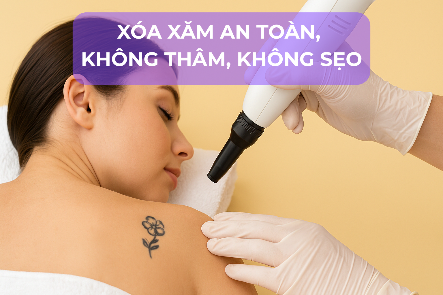 Xóa xăm an toàn, không thâm, không sẹo